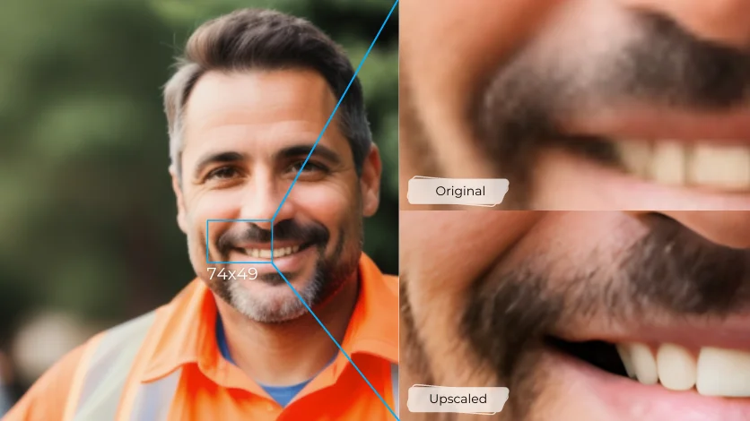 Rehausseur de visage superid